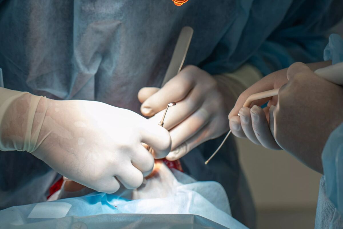 Afectiunea parodontala 2